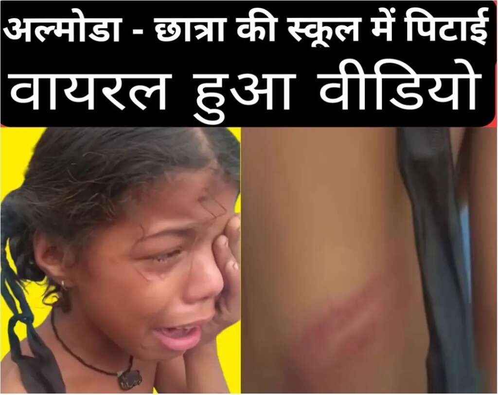 अल्मोड़ा में छात्रा की कथित पिटाई से हड़कंप, घायल छात्रा का वीडियो वायरल; शिक्षा विभाग ने शुरू की जांच